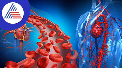 Blood Circulation: ನಿಮ್ಮ ದೇಹದ ಬ್ಲಡ್ ಸರ್ಕ್ಯುಲೇಷನ್ ಸರಿಯಾಗಿದ್ಯಾ? ಚೆಕ್ ಮಾಡ್ಕೊಳಿ