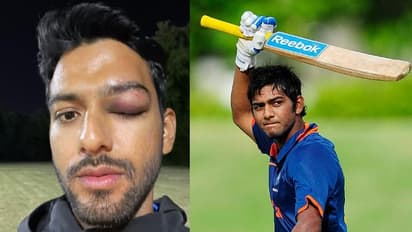 പന്തുകൊണ്ട് കണ്ണിന് പരിക്ക്; ഞെട്ടിക്കുന്ന ചിത്രം പങ്കുവെച്ച് മുന്‍ ഇന്ത്യന്‍ യുവതാരം