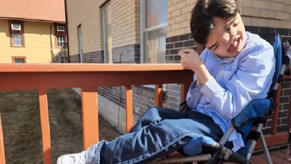 രണ്ട് മുഖവുമായി പിറന്നു; ജീവിക്കില്ലെന്ന് ഡോക്ടര്‍മാര്‍ വിധിയെഴുതിയ കുഞ്ഞ്...