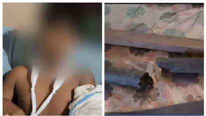 ദഫ് പഠിക്കാൻ പോയ മക്കളെ പട്ടിക കൊണ്ട് അടിച്ച് പരിക്കേൽപ്പിച്ച അച്ഛൻ പിടിയിൽ