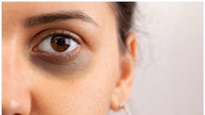 ബിപിയും കൊളസ്ട്രോളും മുതല് ലൈംഗികരോഗങ്ങള് വരെ കണ്ണിലൂടെ തിരിച്ചറിയാം...