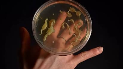 സ്വന്തം ശരീരത്തിലെ ബാക്ടീരിയകൾ കൊണ്ട് ആഭരണങ്ങൾ ഡിസൈൻ ചെയ്ത് സ്കോട്ടിഷ് കലാകാരി