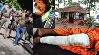 വർക്കലയിൽ പൊലീസുകാർക്ക് മദ്യപ സംഘത്തിന്റെ മർദ്ദനം; രണ്ട് പേർക്ക് പരിക്ക്