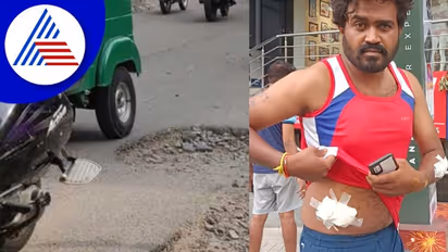 Bengaluru city: ನಗರದಲ್ಲಿ ಈಗ ರಸ್ತೆ ಗುಂಡಿಗಳದ್ದೇ ಕಾರುಬಾರು!