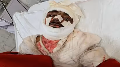 नोएडा: जमीन और रास्ते के विवाद को लेकर चचेरे भाइयों से हुआ झगड़ा, आरोपियों ने पीड़ित युवक को जिंदा जलाया