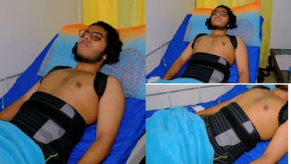 തൃശ്ശൂരിൽ റാഗിങ്, എഞ്ചിനീയറിംഗ് വിദ്യാർഥിക്ക് ഗുരുതര പരിക്ക് ,പരസഹായമില്ലാതെ എഴുന്നേല്‍ക്കാനാകില്ല