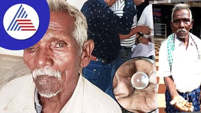 ಮೋಸದ ಜಗತ್ತು...ಕಣ್ಣುಜ್ಜಿಕೊಂಡರೆ ಕೈಗೆ ಬಂದ್ಬಿಡ್ತು ಕಣ್ಣು, ನಕಲಿ ಕಣ್ಣು ಹಾಕಿದ್ದ ಜಾರ್ಖಂಡ್ ಆಸ್ಪತ್ರೆ ಸೀಲ್!