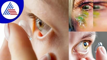 ಅಬ್ಬಬ್ಬಾ..ಇಷ್ಟೊಂದು ಮರೆವಾ? ವ್ಯಕ್ತಿಯ ಕಣ್ಣಲ್ಲಿತ್ತು ಬರೋಬ್ಬರಿ 23 ಲೆನ್ಸ್‌ !