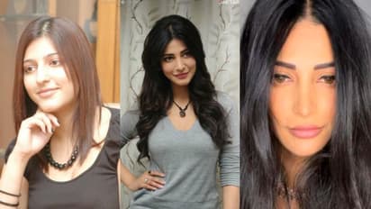 'ഒരുപാട് വേദന സഹിച്ചു, അങ്ങനെയാണ് മൂക്കിന് ശസ്ത്രക്രിയ ചെയ്തത്'; ശ്രുതി ഹാസന് വെളിപ്പെടുത്തി