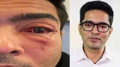 ছলছলে রক্তবর্ণ চোখ! কুণাল, রাজীবের পোস্ট করা অভিষেক বন্দ্যোপাধ্যায়ের চিকিৎসাকালীন ছবি দেখে তোলপাড় নেট দুনিয়া
