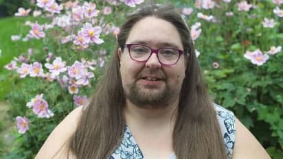 താടിരോമം വളർത്തി, രണ്ടുമാസം കഴിഞ്ഞപ്പോൾ ഷേവ് ചെയ്ത് യുവതി; കാരണം ഇത്