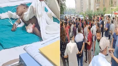 कुत्ते के काटने से मासूम की आंतें निकली बाहर, नोएडा में इलाज के दौरान बच्चे की मौत के बाद फूटा लोगों का गुस्सा