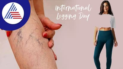 International Legging Day: ಸ್ಕಿನ್ ಟೈಟ್ ಡ್ರೆಸ್ ಹಾಕ್ತೀರಾ ? ಹಾಗಿದ್ರೆ ತೊಂದ್ರೆ ಬಗ್ಗೆನೂ ತಿಳ್ಕೋಬೇಕಲ್ಲ 