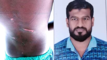 എട്ടും ഒന്‍പതും വയസുള്ള മക്കളെ പൂട്ടിയിട്ട്  കേബിളിനും ചൂരലിനും മര്‍ദ്ദിച്ച് പിതാവ്; അറസ്റ്റ് 