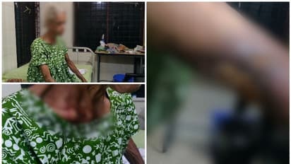 കൊല്ലത്ത് വൃദ്ധ മാതാവിനോട് മരുമകളുടെ ക്രൂരത;പട്ടിണിക്കിട്ട് ക്രൂരമായി മർദ്ദിച്ചു,കണ്ണുകളുടെ കാഴ്ച നഷ്ടപ്പെട്ടു