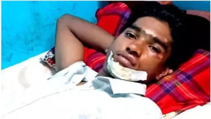 കയറും മുമ്പേ സ്വകാ​ര്യ ബ​സിന്‍റെ ഓട്ടോമാറ്റിക്ക് ഡോര്‍ അടഞ്ഞു; ​ വി​ദ്യാ​ർ​ഥി​ക്ക്​ വീ​ണ്​ പ​രി​ക്ക്