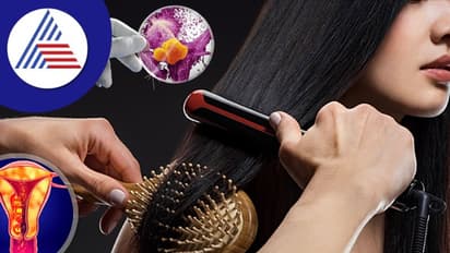 ಹೇರ್ ಸ್ಟ್ರೈಟ್ನರ್ ಬಳಸೋ ಹುಡುಗೀರೆ ಹುಷಾರ್ ! ಜೀವಕ್ಕೇ ತೊಂದ್ರೆಯಾಗ್ಬೋದು