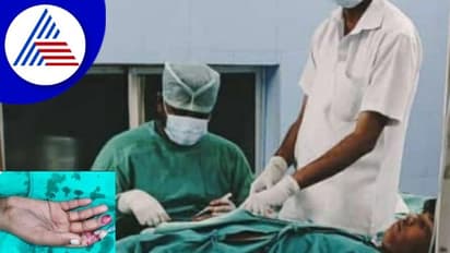 Vijayanagara: ಫ್ಯಾನ್ಗೆ ಸಿಕ್ಕಿ ತುಂಡಾದ ಬೆರಳನ್ನು ಜೋಡಿಸಿ ಮರುಜೀವ ನೀಡಿದ ವೈದ್ಯರು