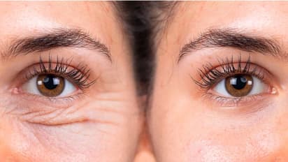 ചര്മ്മം കണ്ടാല് പ്രായം തോന്നിക്കുന്നുണ്ടോ? വീട്ടില് പരീക്ഷിക്കാം ഈ പത്ത് കാര്യങ്ങള്...