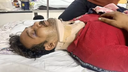 नशे में युवक ने बाइक सवार के साथ जमकर की मारपीट, बदले की भावना से रिटायर्ड दरोगा के बेटे को दी थर्ड डिग्री