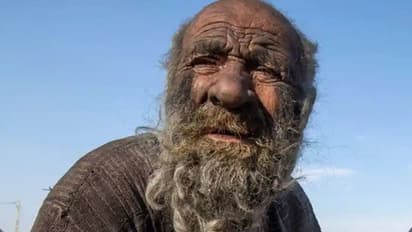 World’s Dirtiest Man: 67 ವರ್ಷದಿಂದ ಸ್ನಾನ ಬಿಟ್ಟಿದ್ದ ವ್ಯಕ್ತಿ ಸ್ನಾನ ಮಾಡಿದ ಬಳಿಕ ಸಾವು!