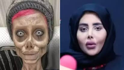 ആഞ്ചലീന ജോളിയുടെ 'സോംബി ലുക്ക്'; ഇനി ഇൻസ്റ്റഗ്രാമിലേക്കില്ല എന്ന് ഇറാനിലെ ഇൻഫ്ലുവൻസർ