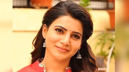 உடல்நல பிரச்சனையால் அவதிப்படும் சமந்தா குணமடைய வாழ்த்திய முன்னாள் கணவர் தம்பி..! 