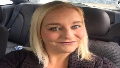 ഉടമയെ കടിച്ചുകീറി പിറ്റ്ബുൾ, നൂറിലധികം തുന്നലുകൾ, അഞ്ച് ഓപ്പറേഷനുകൾ, ജീവൻ രക്ഷപ്പെട്ടത് കഷ്ടി