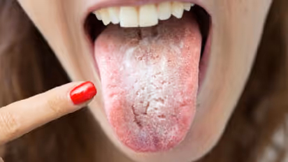 നാവില്‍ ഈ മാറ്റങ്ങള്‍ കണ്ടാല്‍ ശ്രദ്ധിക്കണേ; പരിശോധനയും നടത്താം...