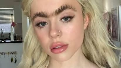 കൂട്ടുപുരികത്തിന്റെ പേരിൽ പരിഹാസം, കമ്പിളിപ്പുഴു എന്നും ഗുഹാമനുഷ്യനെന്നും വിളിക്കുന്നു, മോഡലിന്റെ അനുഭവം