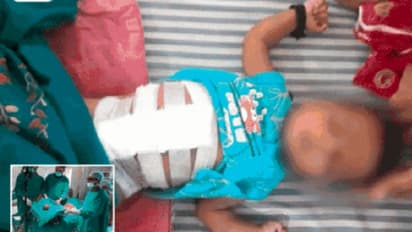 Shocking: 21 ದಿನಗಳ ಹೆಣ್ಣು ಶಿಶುವಿನ ಹೊಟ್ಟೆಯಿಂದ 8 ಭ್ರೂಣ ಹೊರತೆಗೆದ ವೈದ್ಯರು!