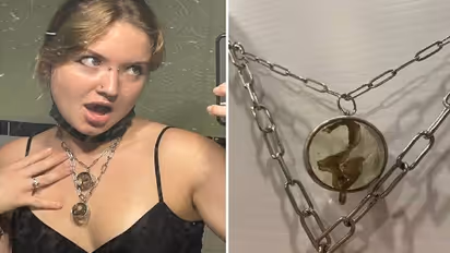 ഫാലോപ്യൻ ട്യൂബുകൾ നെക്ലേസാക്കി മാറ്റി കഴുത്തിൽ അണിഞ്ഞ് 22 -കാരി; കാരണം ഇതാണ്