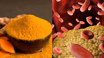 മഞ്ഞളിന് മോശം കൊളസ്ട്രോൾ കുറയ്ക്കാനുള്ള കഴിവുണ്ടോ? 