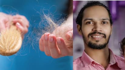 ಕೇರಳದ ಒಂದು ಮೊಟ್ಟೆಯ ಕಥೆ: ಕೂದಲು ಬರಲಿಲ್ಲವೆಂದು ವೈದ್ಯನ ಹೆಸರು ಬರೆದಿಟ್ಟು ಸೂಸೈಡ್‌..!