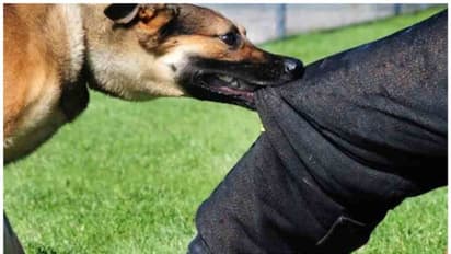 நாய்க்கடி விபரீதம்... 40 பேரைக் கடித்துவிட்டு உயிரை விட்ட இரண்டரை வயது சிறுமி... அதிர்ச்சியில் கிராம மக்கள்