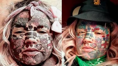 ഇൻഫെക്ഷൻ ബാധിച്ചാലും ശരി, കാൽ മുറിഞ്ഞുവീണാലും ശരി, ടാറ്റൂ ചെയ്യുന്നത് നിർത്തില്ല എന്ന് സ്ത്രീ