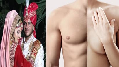 टीचर ने स्टूडेंट से शादी के लिए कराया सेक्स चेंज, जानें जेंडर चेंज सर्जरी का प्रोसीजर