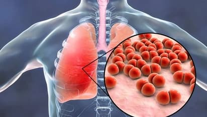 മഞ്ഞുകാലത്ത് ന്യുമോണിയ പിടിപെടാതെ നോക്കാം ; ശ്രദ്ധിക്കേണ്ടത് എന്തൊക്കെ? 
