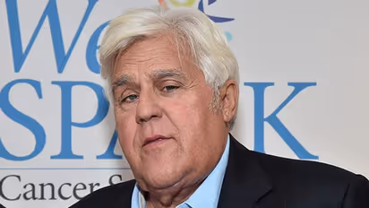 US comedian Jay Leno suffered serious burns in gasoline fire