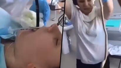 Russian doctors pull out 4 feet long snake from woman's mouth; horrifying video goes viral