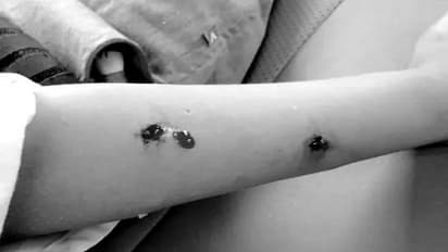 ग्रेटर नोएडा: लिफ्ट में कुत्ते के काटने पर प्राधिकरण ने की कार्रवाई, मालिक पर लगाया 10 हजार रुपए का जुर्माना