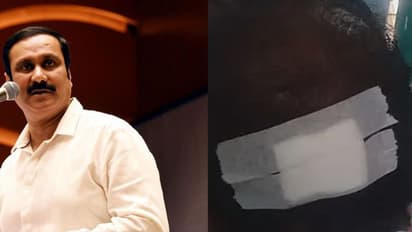 கஞ்சா போதையில் தலைமை ஆசிரியரின் மண்டை உடைப்பு.. எங்கே போகிறது மாணவர் சமுதாயம்.. கதறும் அன்புமணி.!