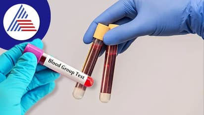 ಜಗತ್ತಿನಲ್ಲಿ ಕೇವಲ 45 ಜನರಲ್ಲಿ ಮಾತ್ರ ಇರೋ ಗೋಲ್ಡನ್ ಬ್ಲಡ್ ಗ್ರೂಪ್ ಬಗ್ಗೆ ಕೇಳಿದ್ದೀರಾ ?