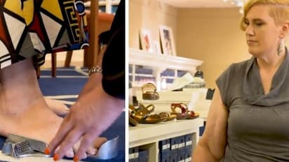 അസാധാരണമായ കാല്‍പാദങ്ങളുമായി സ്ത്രീ; ചെരുപ്പോ ഷൂവോ ഒരിക്കലും പാകമാകില്ല!