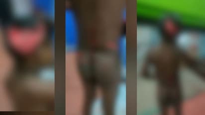 മലപ്പുറം താനൂരിൽ നാല് വയസുകാരനെ തെരുവ് നായ്കൾ കടിച്ചു കീറി: തലയും മുതുകിലും കടിച്ചെടുത്ത നിലയിൽ  