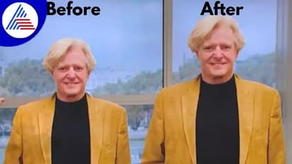 ಇಷ್ಟೊಂದು ಹೈಟ್ ಬೇಕಿತ್ತಾ ? 3 ಇಂಚು ಎತ್ತರವಾಗಲು 1.2 ಕೋಟಿ ಖರ್ಚು !