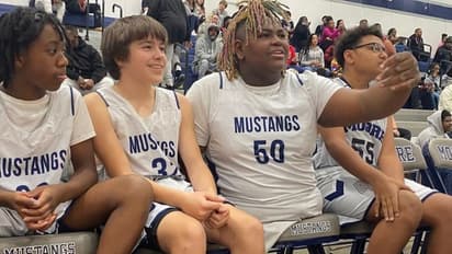 ಕಾಸಿಲ್ಲ ಕಾರಿಲ್ಲ ಅಂತ ಅಳ್ಬೇಡಿ... ಇವನಿಗೆ ನೋಡಿ ಕಾಲೇ ಇಲ್ಲ...