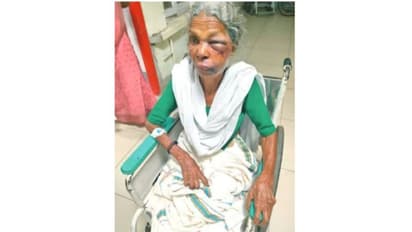 വെള്ളം ചോദിച്ചെത്തിയ യുവാവ് വൃദ്ധയുടെ മുഖത്തടിച്ച് ശേഷം മാല പൊട്ടിച്ച് കടന്നു