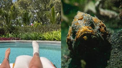 ഹണിമൂണിന് പോയി, ലോകത്തിലെ തന്നെ വിഷമുള്ള മീനിന്റെ കുത്തേറ്റു; ആ ദിവസത്തെ കുറിച്ച് ഓർക്കാൻപോലും വയ്യെന്ന് യുവതി