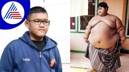 Arya Permana: 200Kg ತೂಕದ ಬಾಲಕ ತೂಕ ಇಳಿಸಿಕೊಂಡಿದ್ದು ಹೇಗೆ ಗೊತ್ತಾ?